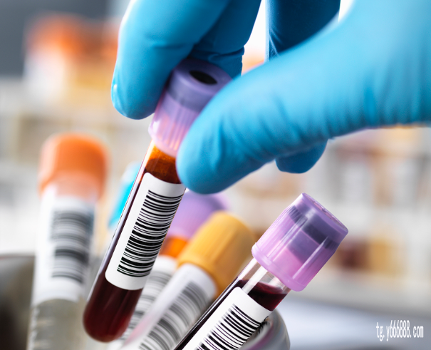 国内验血查男女多少钱,香港验血看男女的渠道多久出结果